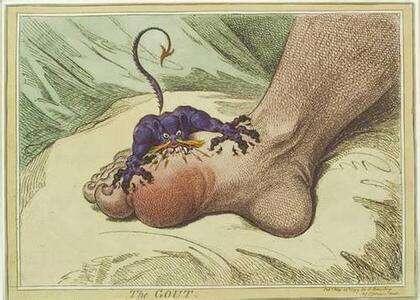 痛风对我们身体带来的危害 痛风对我们身体带来的危害