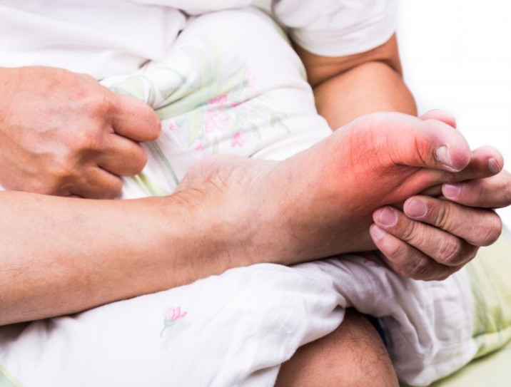 很多患者还不知道类风湿病是怎样形成的 很多患者还不知道类风湿病是怎样形成的