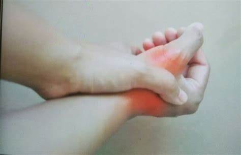 类风湿病是样形成的?原因是什么? 类风湿病是样形成的?原因是什么?