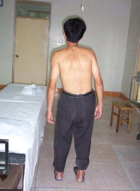 警惕!腰疼是怎么回事? 警惕!腰疼是怎么回事?